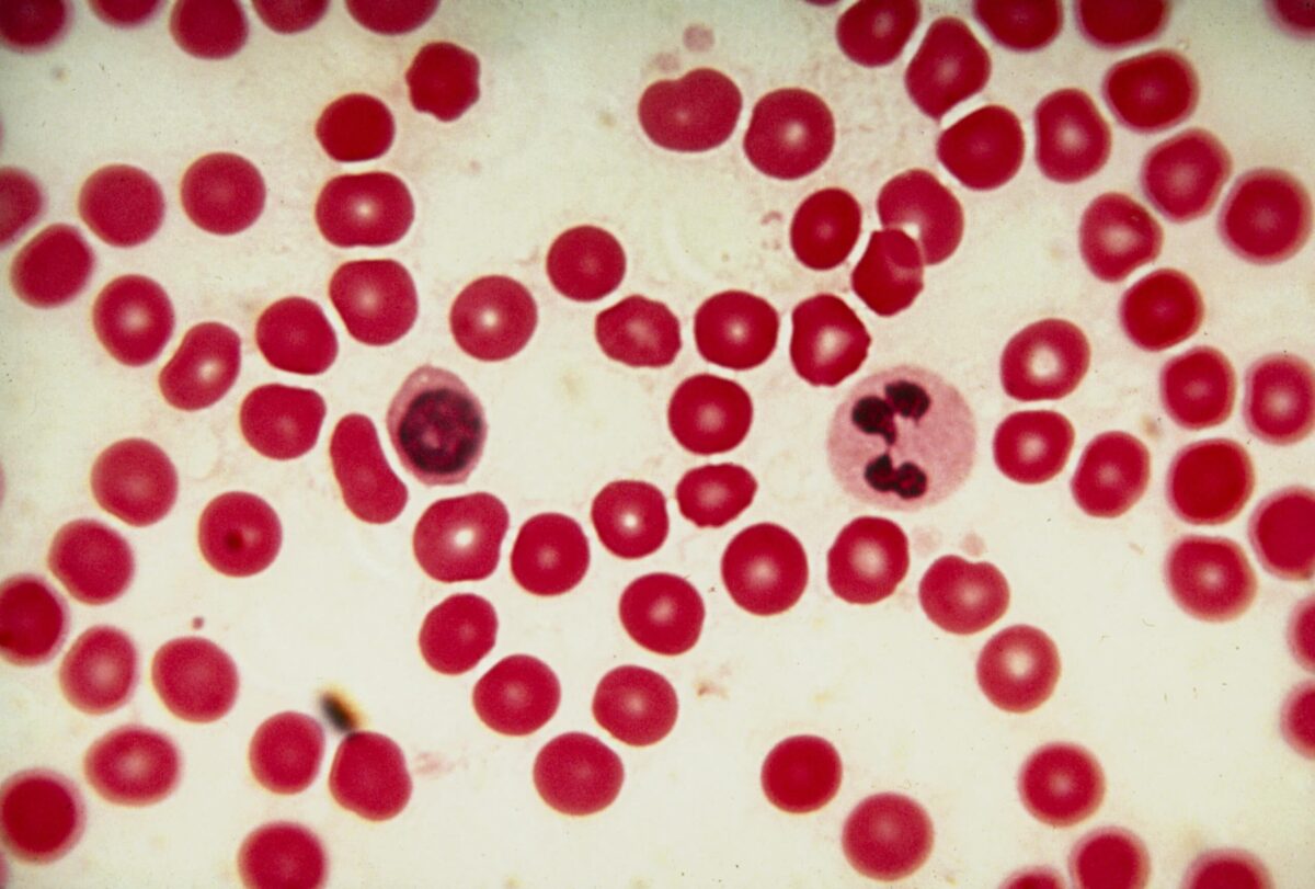 Light micrograph of human red blood cells (erythrocytes), with two unidentified white blood cells (leucocytes) near the centre. The function of the erythrocytes is the distribution & transport of oxygen & carbon dioxide to & from the cells of the body. Surrounded by a thin elastic membrane, the whole of the interior is filled with haemoglobin, an iron-containing red pigment which has a good oxygen-carrying capacity. Erythrocytes have a biconcave disc shape & are flexible so that they can accommodate themselves to the smallest of capillaries. The function of the leucocytes is that of defense against disease. Magnification: x270 at 35mm size.