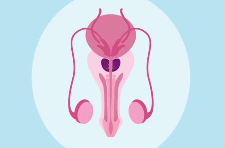 Conozca las posibles señales de advertencia del cáncer de próstata