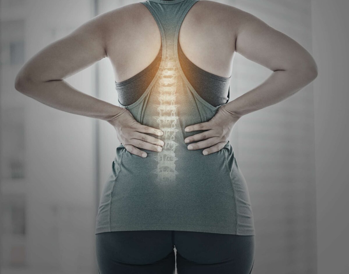 Fitness, spine problem and woman with back pain, muscle and joint ache from exercise, workout and training. Sports health, anatomy and skeleton x ray of girl for osteoporosis, injury and accident.