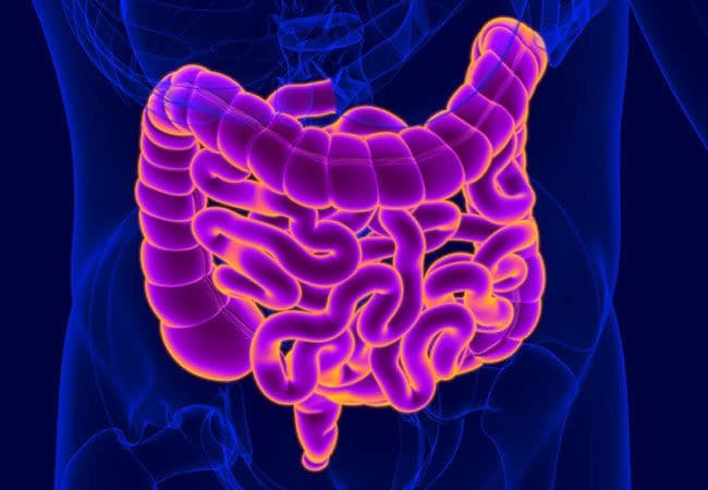 El cáncer colorrectal se desarrolla cuando las células que forran el colon y el recto se multiplican incontroladamente