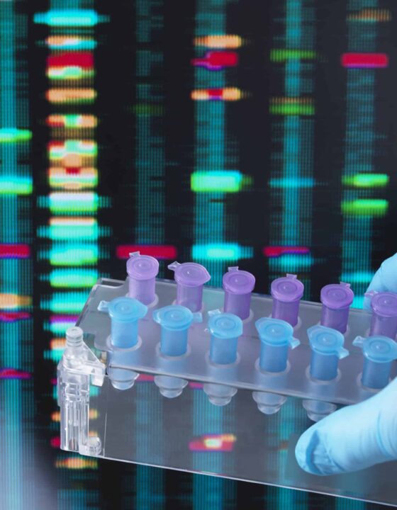 DNA Research, Scientist holding up a tray of DNA samples with results on the computer screen