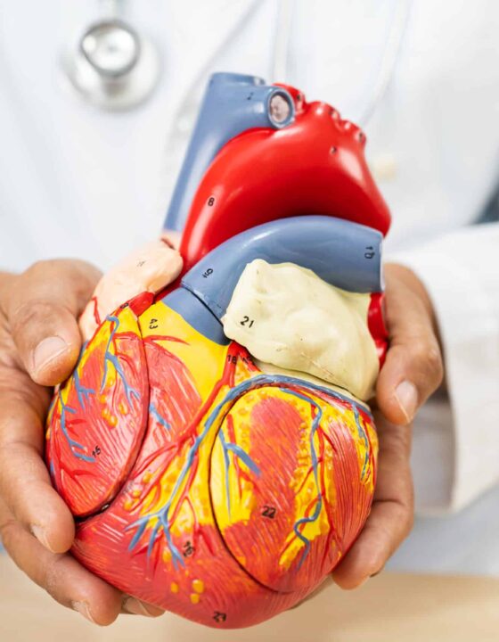 Cardiovascular disease CVD, Asian doctor holding human anatomy model for learn and treat heart disease.