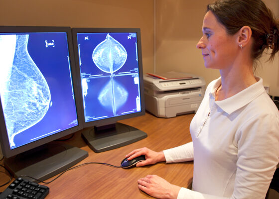 Radiology technician examens mammography test on location